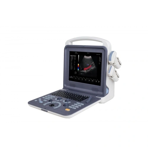 Escáner de ultrasonido Doppler color cardíaco portátil 4D
